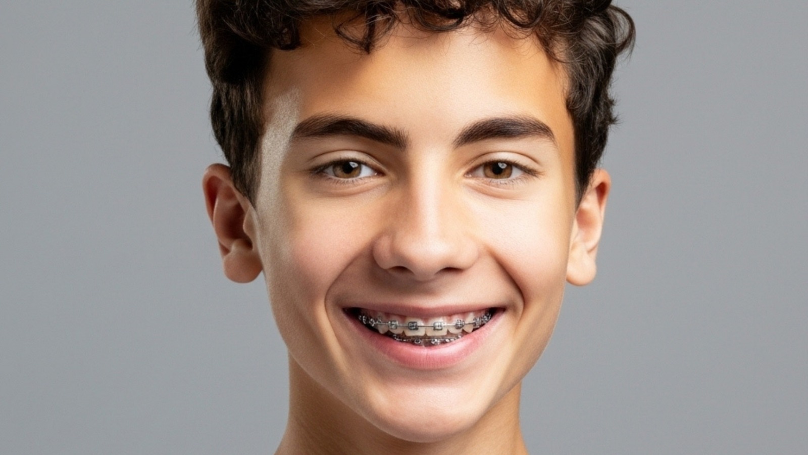 Brackets Tradicionales